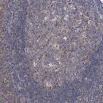 ARFGAP1 Antibody in Immunohistochemistry (Paraffin) (IHC (P))