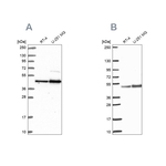 ARFGAP1 Antibody in Western Blot (WB)