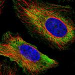 DYX1C1 Polyclonal Antibody