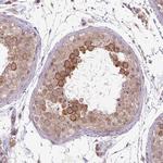 DYX1C1 Antibody in Immunohistochemistry (Paraffin) (IHC (P))