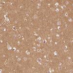 WDR7 Antibody in Immunohistochemistry (Paraffin) (IHC (P))