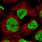 hnRNP C Antibody in Immunocytochemistry (ICC/IF)