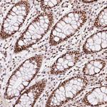 hnRNP C Antibody in Immunohistochemistry (Paraffin) (IHC (P))