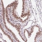 hnRNP C Antibody in Immunohistochemistry (Paraffin) (IHC (P))