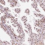 hnRNP C Antibody in Immunohistochemistry (Paraffin) (IHC (P))