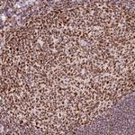 hnRNP C Antibody in Immunohistochemistry (Paraffin) (IHC (P))