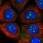 RP11-849H4.2 Antibody in Immunocytochemistry (ICC/IF)