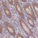 RP11-849H4.2 Antibody in Immunohistochemistry (Paraffin) (IHC (P))