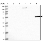 ALDH3A1 Antibody in Western Blot (WB)