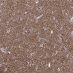 GNAL Polyclonal Antibody