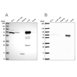 PCK2 Antibody in Western Blot (WB)