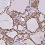 SNX5 Antibody in Immunohistochemistry (Paraffin) (IHC (P))