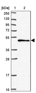 SNX5 Antibody in Western Blot (WB)
