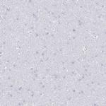 CCL21 Antibody in Immunohistochemistry (Paraffin) (IHC (P))