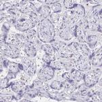 CCL21 Antibody in Immunohistochemistry (Paraffin) (IHC (P))