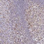 CCL21 Polyclonal Antibody