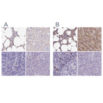 Catalase Polyclonal Antibody