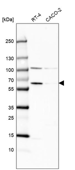 Catalase Antibody in Western Blot (WB)