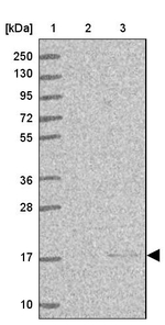 ENSA Antibody in Western Blot (WB)