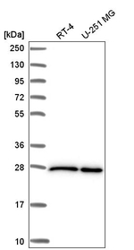 eIF4E Antibody in Western Blot (WB)