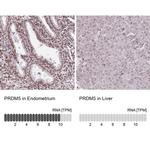 PRDM5 Antibody