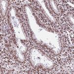 PRDM5 Antibody in Immunohistochemistry (Paraffin) (IHC (P))