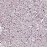 PRDM5 Antibody in Immunohistochemistry (Paraffin) (IHC (P))