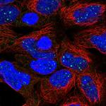 DISP1 Polyclonal Antibody