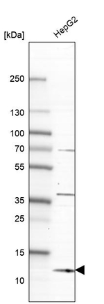 Diazepam Binding Inhibitor Antibody in Western Blot (WB)