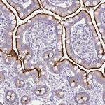 RhoC Polyclonal Antibody