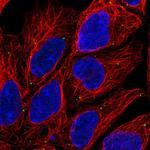 LAMP3 Polyclonal Antibody