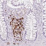 LAMP3 Antibody in Immunohistochemistry (Paraffin) (IHC (P))