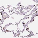 LAMP3 Antibody in Immunohistochemistry (Paraffin) (IHC (P))