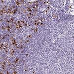 LAMP3 Antibody in Immunohistochemistry (Paraffin) (IHC (P))