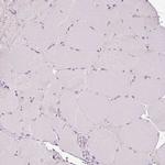 LAMP3 Antibody in Immunohistochemistry (Paraffin) (IHC (P))