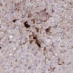 Thrombin Antibody in Immunohistochemistry (Paraffin) (IHC (P))