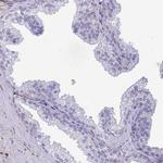 Thrombin Antibody in Immunohistochemistry (Paraffin) (IHC (P))