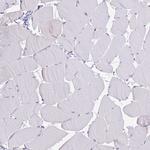 Thrombin Antibody in Immunohistochemistry (Paraffin) (IHC (P))