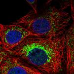Neuroplastin Antibody in Immunocytochemistry (ICC/IF)