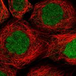 RAD51AP1 Polyclonal Antibody