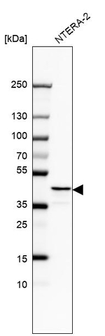 RAD51AP1 Antibody in Western Blot (WB)