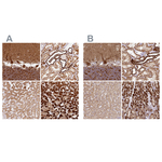 MT-CO2 Antibody in Immunohistochemistry (Paraffin) (IHC (P))