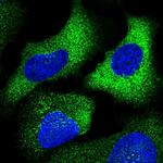 CHST10 Polyclonal Antibody