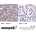 PDIA2 Antibody
