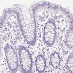 PDIA2 Antibody in Immunohistochemistry (Paraffin) (IHC (P))