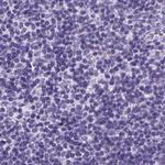 PDIA2 Antibody in Immunohistochemistry (Paraffin) (IHC (P))