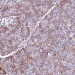 PDIA2 Antibody in Immunohistochemistry (Paraffin) (IHC (P))
