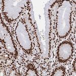 hnRNP L Polyclonal Antibody