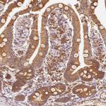 EEF1A1 Antibody in Immunohistochemistry (Paraffin) (IHC (P))
