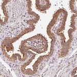EEF1A1 Antibody in Immunohistochemistry (Paraffin) (IHC (P))